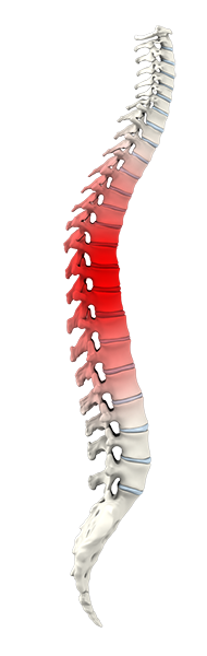 Spine Trauma